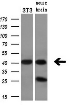BCAT1 Mouse anti-Canine, Human, Mouse, Clone: OTI3F5, lyophilized, TrueMAB