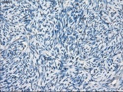 BCKDK Mouse anti-Human, Clone: OTI11C9, lyophilized, TrueMAB 100 &mu;g;