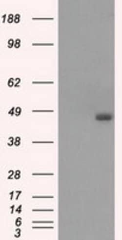 BCKDK Mouse anti-Human, Clone: OTI11C9, lyophilized, TrueMAB 100 &mu;g;