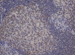 BCL10 Mouse anti-Human, Clone: OTI4H9, lyophilized, TrueMAB 100 &mu;g;