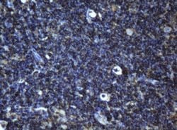 BCL10 Monoclonal Antibody (OTI1B3), TrueMAB , OriGene 100 &mu;L; Unconjugated:Antibodies,
