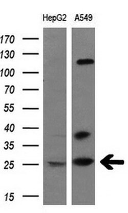 BCL10 Monoclonal Antibody (OTI6A4), TrueMAB , OriGene 100 &mu;L; Unconjugated:Antibodies,