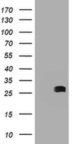 BCL10 Monoclonal Antibody (OTI4H9), TrueMAB , OriGene:Antibodies:Primary
