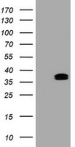 BCL10 Mouse anti-Human, Clone: OTI2B12, lyophilized, TrueMAB 100 &mu;g;