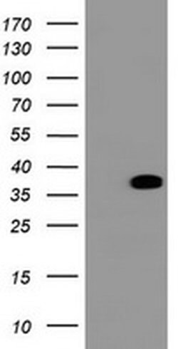 BCL10 Monoclonal Antibody (OTI3C2), TrueMAB , OriGene 100 &mu;L; Unconjugated:Antibodies,