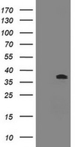 BCL10 Monoclonal Antibody (OTI6A8), TrueMAB , OriGene 100 &mu;L; Unconjugated:Antibodies,