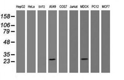 BCL10 Monoclonal Antibody (OTI6A8), TrueMAB , OriGene 100 &mu;L; Unconjugated:Antibodies,