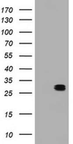BCL10 Monoclonal Antibody (OTI1F11), TrueMAB , OriGene:Antibodies:Primary