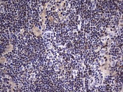 BCL2 Monoclonal Antibody (OTI2E5), TrueMAB , OriGene 30 &mu;L; Unconjugated:Antibodies,
