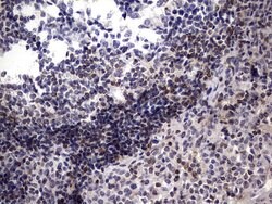 BCL2 Monoclonal Antibody (OTI2E5), TrueMAB , OriGene 30 &mu;L; Unconjugated:Antibodies,