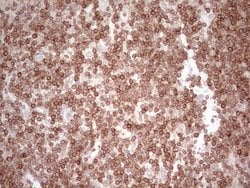 BCL2 Monoclonal Antibody (OTI10C7), TrueMAB , OriGene 30 &mu;L; Unconjugated:Antibodies,