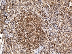 BCL2 Monoclonal Antibody (OTI7H9), TrueMAB , OriGene 100 &mu;L; Unconjugated:Antibodies,
