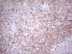 BCL2 Monoclonal Antibody (OTI3B8), TrueMAB , OriGene 100 &mu;L; Unconjugated:Antibodies,