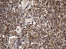 BCL2 Mouse anti-Human, Clone: OTI5F8, lyophilized, TrueMAB 100 &mu;g; Unconjugated:Antibodies,