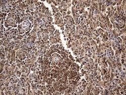 BCL2 Mouse anti-Human, Clone: OTI5F8, lyophilized, TrueMAB 100 &mu;g; Unconjugated:Antibodies,