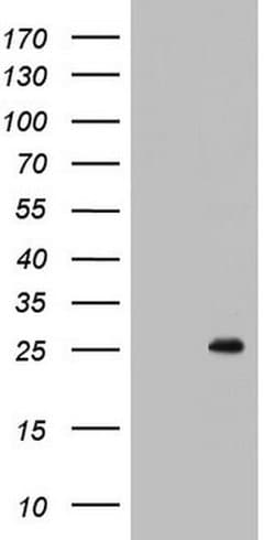 BCL2 Monoclonal Antibody (OTI1E9), TrueMAB , OriGene:Antibodies:Primary