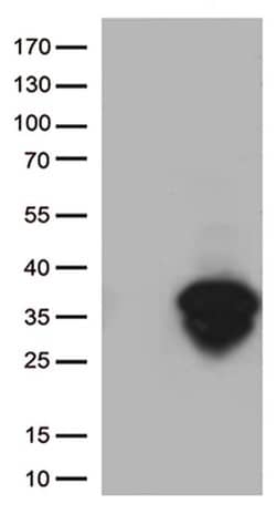 BCL2 Monoclonal Antibody (OTI10C7), TrueMAB , OriGene:Antibodies:Primary