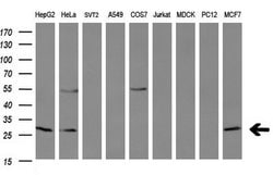 BCL2 Monoclonal Antibody (OTI10C7), TrueMAB , OriGene 30 &mu;L; Unconjugated:Antibodies,