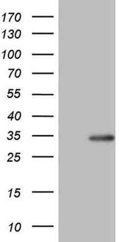 BCL2 Monoclonal Antibody (OTI7H9), TrueMAB , OriGene 100 &mu;L; Unconjugated:Antibodies,