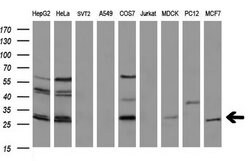 BCL2 Monoclonal Antibody (OTI7H9), TrueMAB , OriGene:Antibodies:Primary