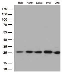 BCL2 Mouse anti-Human, Clone: OTI5H4, lyophilized, TrueMAB 100 &mu;g; Unconjugated:Antibodies,