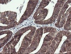 BCL2L1 Mouse anti-Human, Clone: OTI2D1, lyophilized, TrueMAB 100 &mu;g;