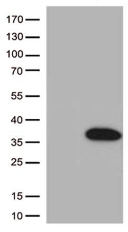 BCL2L1 Mouse anti-Human, Clone: OTI2D1, lyophilized, TrueMAB 100 &mu;g;
