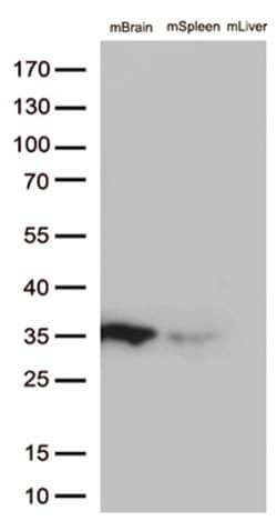 BCL2L1 Mouse anti-Human, Clone: OTI2D1, lyophilized, TrueMAB 100 &mu;g;