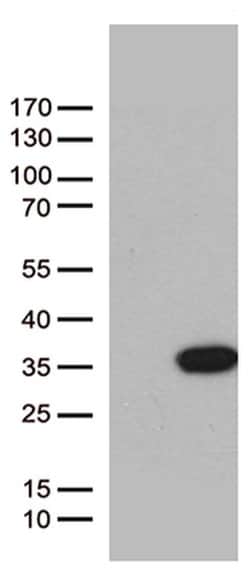 BCL2L11 Monoclonal Antibody (OTI2H5), TrueMAB , OriGene 100 &mu;L; Unconjugated:Antibodies,