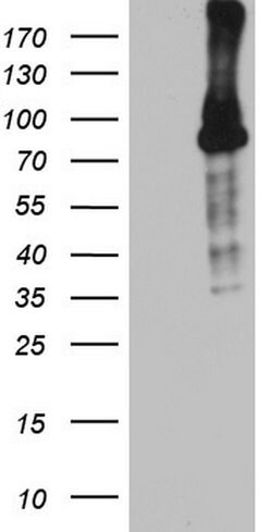 BCL6 Monoclonal Antibody (OTI11D8), TrueMAB , OriGene 100 &mu;L; Unconjugated:Anticuerpos