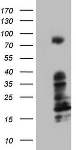BCL6 Mouse anti-Human, Clone: OTI20A3, lyophilized, TrueMAB 100 &mu;g;