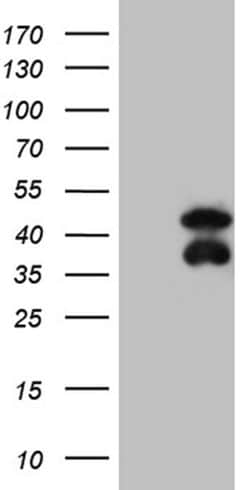 BCL7B Monoclonal Antibody (OTI2D9), TrueMAB , OriGene:Antibodies:Primary