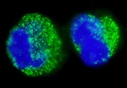 BCR Rabbit anti-Human, Polyclonal, Bethyl Laboratories 100 &mu;L; Unconjugated:Antibodies,
