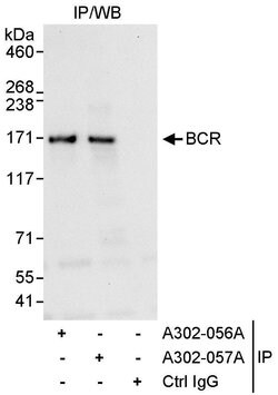 BCR Rabbit anti-Human, Polyclonal, Bethyl Laboratories 100 &mu;L; Unconjugated:Antibodies,