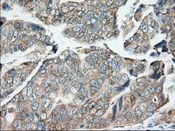 BDH2 Monoclonal Antibody (OTI2G1), TrueMAB , OriGene 30 &mu;L; Unconjugated:Antibodies,