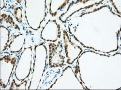 BDH2 Monoclonal Antibody (OTI2G1), TrueMAB , OriGene 30 &mu;L; Unconjugated:Antibodies,