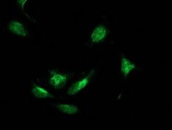 BECN1 Monoclonal Antibody (OTI2C5), TrueMAB , OriGene 100 &mu;L; Unconjugated:Antibodies,