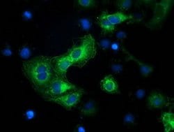 BECN1 Monoclonal Antibody (OTI1E1), TrueMAB , OriGene:Antibodies:Primary