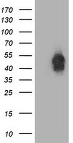 BECN1 Monoclonal Antibody (OTI3F3), TrueMAB , OriGene 100 &mu;L; Unconjugated:Antibodies,