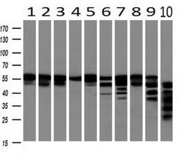 BECN1 Monoclonal Antibody (OTI3F3), TrueMAB , OriGene 100 &mu;L; Unconjugated:Antibodies,