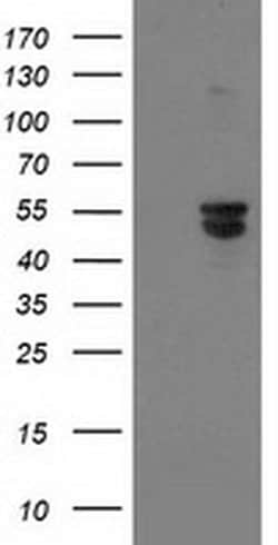 BECN1 Monoclonal Antibody (OTI2C5), TrueMAB , OriGene 100 &mu;L; Unconjugated:Antibodies,
