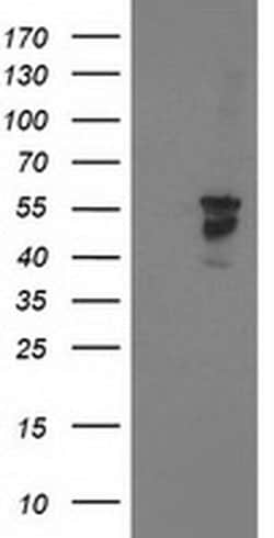 BECN1 Monoclonal Antibody (OTI3C3), TrueMAB , OriGene 100 &mu;L; Unconjugated:Antibodies,