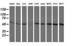 BECN1 Monoclonal Antibody (OTI3C3), TrueMAB , OriGene:Antibodies:Primary
