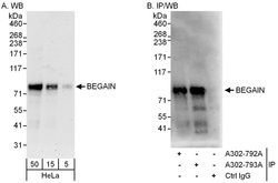 BEGAIN Rabbit anti-Human, Polyclonal, Bethyl Laboratories 100 &mu;L; Unconjugated:Antibodies,