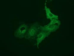 BEST3 Monoclonal Antibody (OTI1B6), TrueMAB , OriGene 30 &mu;L; Unconjugated:Antibodies,