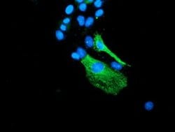 BEST3 Monoclonal Antibody (OTI1H5), TrueMAB , OriGene 100 &mu;L; Unconjugated:Antibodies,