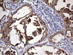 BFSP1 Monoclonal Antibody (OTI2D2), TrueMAB , OriGene 100 &mu;L; Unconjugated:Antibodies,