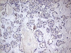 BFSP1 Mouse anti-Human, Clone: OTI1B9, lyophilized, TrueMAB 100 &mu;g;