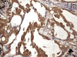 BFSP1 Monoclonal Antibody (OTI1F4), TrueMAB , OriGene 100 &mu;L; Unconjugated:Antibodies,