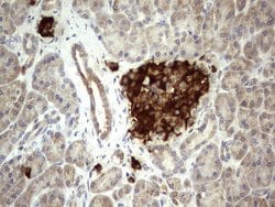 BFSP1 Monoclonal Antibody (OTI1F4), TrueMAB , OriGene 100 &mu;L; Unconjugated:Antibodies,